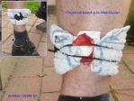 Bild#56(Druckverband-MacGyver_GUM-SI_Anwendung_Mill.jpg)